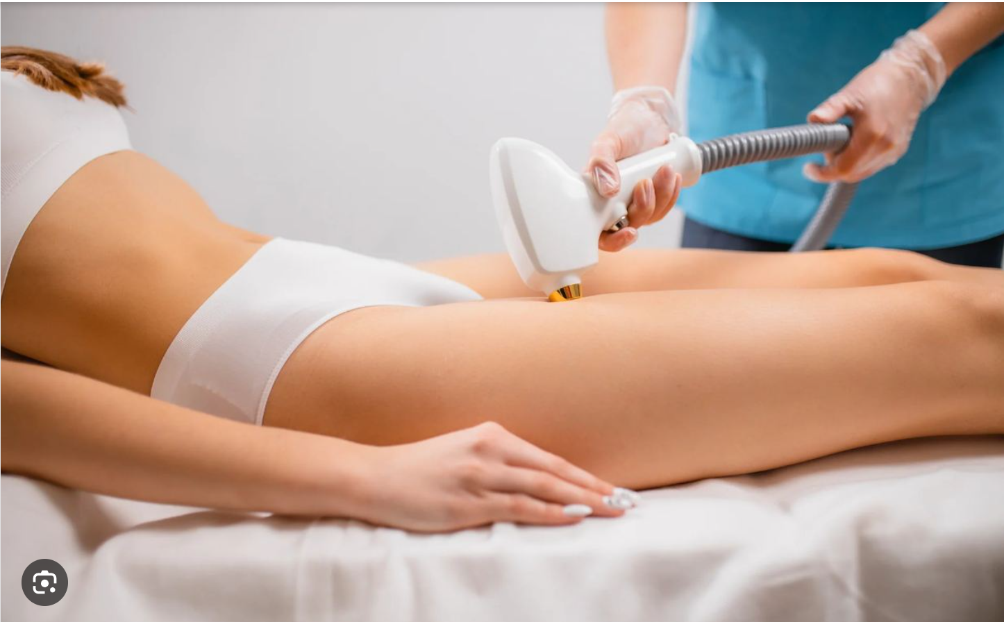 Laser hair removal treatment for smooth skin in Plano, Texas